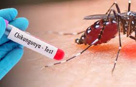 சிக்குன்குனியா